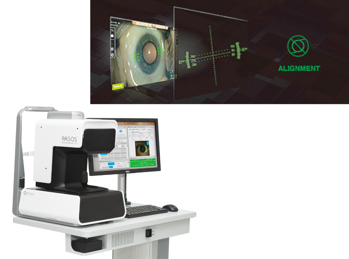 白内障手術装置